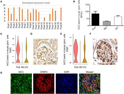 MCC Regulator of WNT Signaling Pathway (MCC) Is a Podocyte Essential Gene